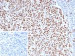 EZH2/KMT6 Antibody in Immunohistochemistry (Paraffin) (IHC (P))