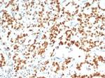 EZH2/KMT6 Antibody in Immunohistochemistry (Paraffin) (IHC (P))