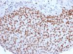 EZH2/KMT6 Antibody in Immunohistochemistry (Paraffin) (IHC (P))