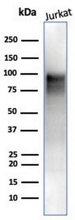 EZH2/KMT6 Antibody in Western Blot (WB)