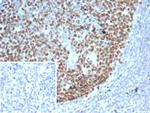 EZH2/KMT6 Antibody in Immunohistochemistry (Paraffin) (IHC (P))