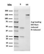 Coagulation Factor VII/F7 Antibody in SDS-PAGE (SDS-PAGE)