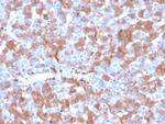 Coagulation Factor VII/F7 Antibody in Immunohistochemistry (Paraffin) (IHC (P))