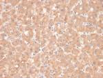 Coagulation Factor VII/F7 Antibody in Immunohistochemistry (Paraffin) (IHC (P))