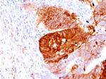 ALDH1A1 (Aldehyde Dehydrogenase 1A1) Antibody in Immunohistochemistry (Paraffin) (IHC (P))