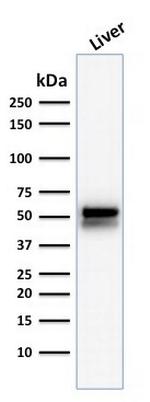 ALDH1A1 (Aldehyde Dehydrogenase 1A1) Antibody in Western Blot (WB)