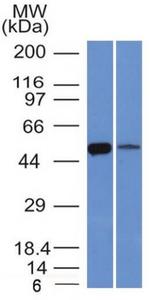 ALDH1A1 (Aldehyde Dehydrogenase 1A1) Antibody in Western Blot (WB)