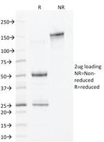 ALDH1A1 (Aldehyde Dehydrogenase 1A1) Antibody in SDS-PAGE (SDS-PAGE)