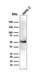 ALDH1A1 (Aldehyde Dehydrogenase 1A1) Antibody in Western Blot (WB)