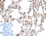 ALDH1A1 (Aldehyde Dehydrogenase 1A1) Antibody in Immunohistochemistry (Paraffin) (IHC (P))