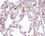 ALDH1A1 (Aldehyde Dehydrogenase 1A1) Antibody in Immunohistochemistry (Paraffin) (IHC (P))