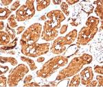 ALDH1A1 (Aldehyde Dehydrogenase 1A1) Antibody in Immunohistochemistry (Paraffin) (IHC (P))