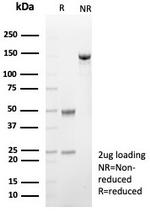 Fatty Acid Binding Protein 4 (FABP4) Antibody in SDS-PAGE (SDS-PAGE)