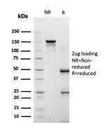 Fatty Acid Binding Protein 4 (FABP4) Antibody in SDS-PAGE (SDS-PAGE)