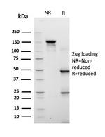 Fatty Acid Binding Protein 4 (FABP4) Antibody in Immunoelectrophoresis (IE)