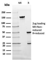 Fatty Acid Binding Protein 4 (FABP4) Antibody in SDS-PAGE (SDS-PAGE)