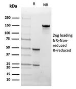 Fatty Acid Binding Protein 4 (FABP4) Antibody in SDS-PAGE (SDS-PAGE)