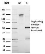 Fatty Acid Binding Protein 4 (FABP4) Antibody in SDS-PAGE (SDS-PAGE)