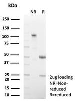 Fatty Acid Binding Protein 4 (FABP4) Antibody in SDS-PAGE (SDS-PAGE)