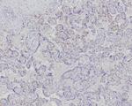 Fatty Acid Binding Protein 4 (FABP4) Antibody in Immunohistochemistry (Paraffin) (IHC (P))