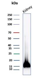 Fatty Acid Binding Protein (Liver)/FABP1 Antibody in Western Blot (WB)