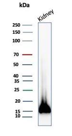 Fatty Acid Binding Protein (Liver)/FABP1 Antibody in Western Blot (WB)