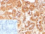 Fatty Acid Binding Protein (Liver)/FABP1 Antibody in Immunohistochemistry (Paraffin) (IHC (P))