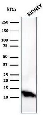 Fatty Acid Binding Protein (Liver)/FABP1 Antibody in Western Blot (WB)