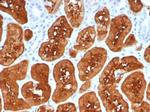 Fatty Acid Binding Protein (Liver)/FABP1 Antibody in Immunohistochemistry (Paraffin) (IHC (P))