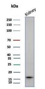 Fatty Acid Binding Protein (Liver)/FABP1 Antibody in Western Blot (WB)