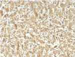 Fatty Acid Binding Protein (Liver)/FABP1 Antibody in Immunohistochemistry (Paraffin) (IHC (P))