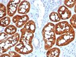 Fatty Acid Binding Protein (Liver)/FABP1 Antibody in Immunohistochemistry (Paraffin) (IHC (P))