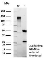 Fatty Acid Binding Protein (Liver)/FABP1 Antibody in SDS-PAGE (SDS-PAGE)