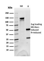 Fatty Acid Binding Protein (Liver)/FABP1 Antibody in SDS-PAGE (SDS-PAGE)