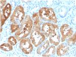 Fatty Acid Binding Protein (Liver)/FABP1 Antibody in Immunohistochemistry (Paraffin) (IHC (P))