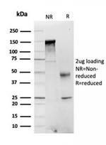 Fatty Acid Binding Protein (Liver)/FABP1 Antibody in SDS-PAGE (SDS-PAGE)