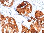 Fatty Acid Binding Protein (Liver)/FABP1 Antibody in Immunohistochemistry (Paraffin) (IHC (P))