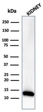 Fatty Acid Binding Protein (Liver)/FABP1 Antibody in Western Blot (WB)