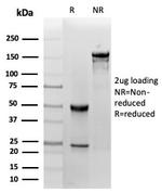 Fatty Acid Binding Protein (Liver)/FABP1 Antibody in SDS-PAGE (SDS-PAGE)