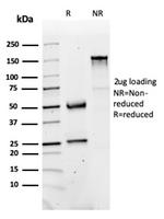 Fatty Acid Binding Protein (Liver)/FABP1 Antibody in SDS-PAGE (SDS-PAGE)