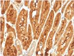 Fatty Acid Binding Protein (Liver)/FABP1 Antibody in Immunohistochemistry (Paraffin) (IHC (P))