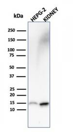 Fatty Acid Binding Protein (Liver)/FABP1 Antibody in Western Blot (WB)