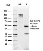 Fatty Acid Binding Protein (Liver)/FABP1 Antibody in SDS-PAGE (SDS-PAGE)