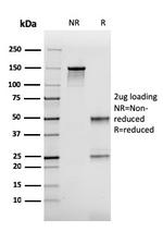 FABP2 (Marker of Metastatic Potential in Colorectal Cancer) Antibody in SDS-PAGE (SDS-PAGE)