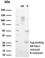 FABP2 (Marker of Metastatic Potential in Colorectal Cancer) Antibody in SDS-PAGE (SDS-PAGE)