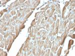 Heart Fatty Acid Binding Protein (H-FABP)/FABP3 Antibody in Immunohistochemistry (Paraffin) (IHC (P))