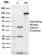 Heart Fatty Acid Binding Protein (H-FABP)/FABP3 Antibody in SDS-PAGE (SDS-PAGE)