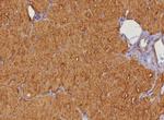 Heart Fatty Acid Binding Protein (H-FABP)/FABP3 Antibody in Immunohistochemistry (Paraffin) (IHC (P))