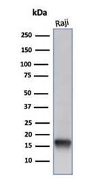 FABP5 (Marker of Metastatic Potential in Colorectal Cancer) Antibody in Western Blot (WB)