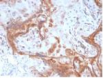 Fibroblast Activation Protein Alpha/FAP-1 Antibody in Immunohistochemistry (Paraffin) (IHC (P))